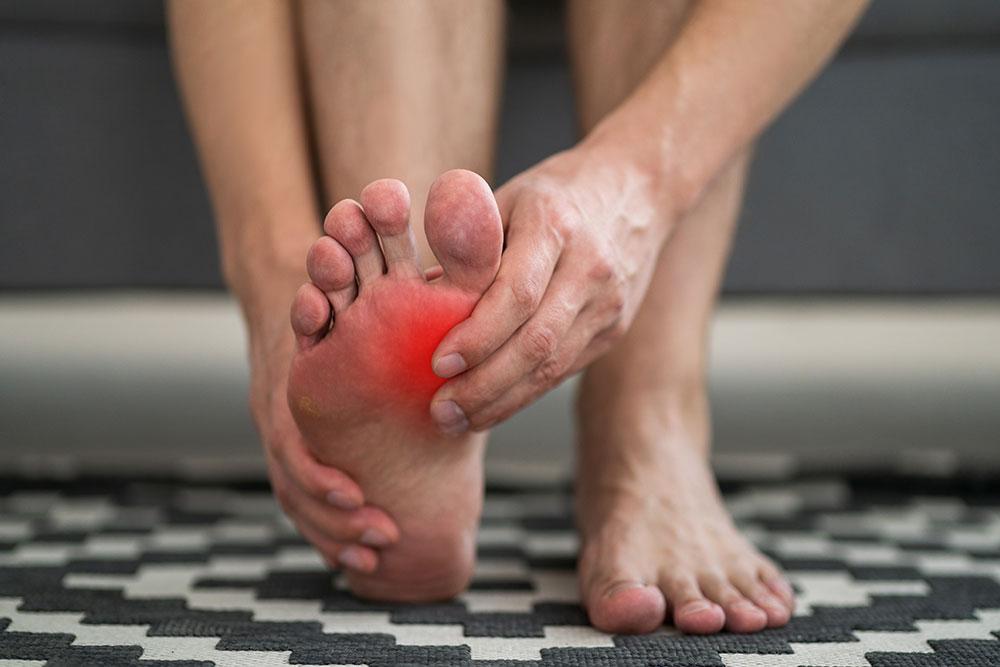 Artrite reumatoide piede: rimedi, trattamento e vantaggi delle calze a compressione